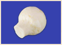 Femoral Head